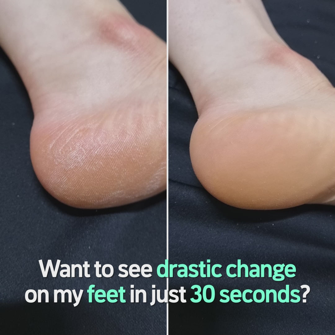 One Day's You SSG Help Me Foot Peeling Video